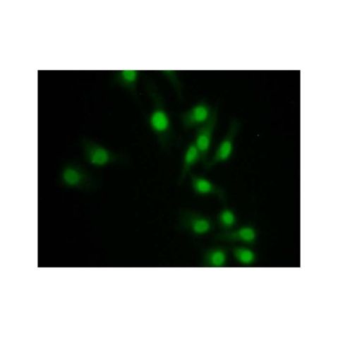 aladdin 阿拉丁 Ab128246 SMAD9 Antibody pAb; Rabbit anti Human SMAD9 Antibody; WB, IHC, IF, ICC; Unconjugated