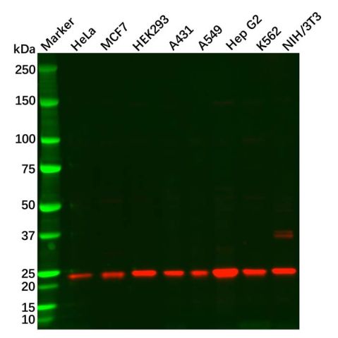 aladdin 阿拉丁 Ab128615 SOD2/MnSOD Antibody pAb; Rabbit anti Human SOD2/MnSOD Antibody; WB, IHC ; Unconjugated