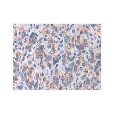 aladdin 阿拉丁 Ab128615 SOD2/MnSOD Antibody pAb; Rabbit anti Human SOD2/MnSOD Antibody; WB, IHC ; Unconjugated