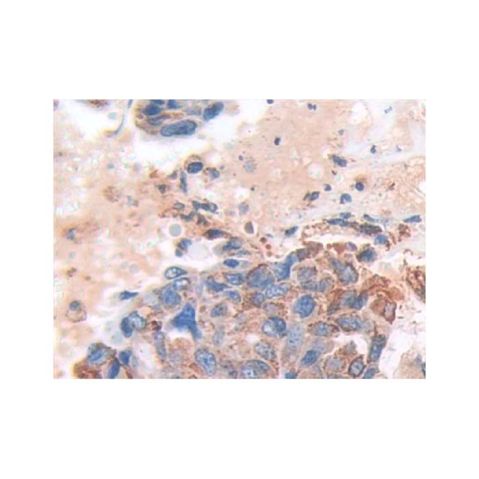 aladdin 阿拉丁 Ab128615 SOD2/MnSOD Antibody pAb; Rabbit anti Human SOD2/MnSOD Antibody; WB, IHC ; Unconjugated