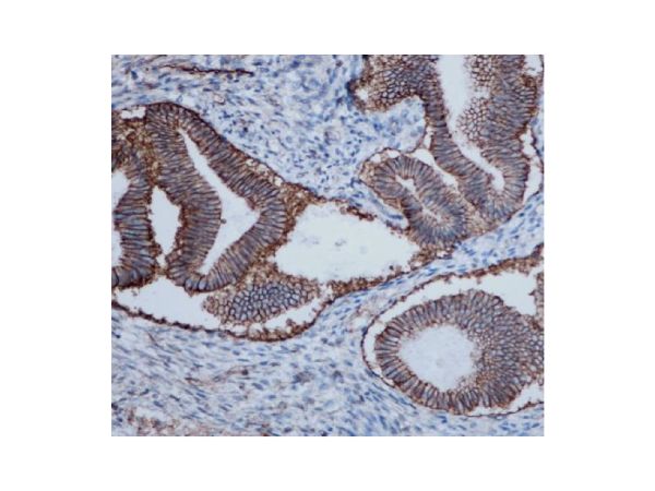 aladdin 阿拉丁 Ab128631 Recombinant ATP1A1 Antibody Recombinant (RR685); Rabbit anti Human ATP1A1 Antibody; WB, IHC, Flow, IP; Unconjugated