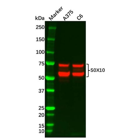 aladdin 阿拉丁 Ab128734 Recombinant SOX10 Antibody Recombinant (RR643); Rabbit anti Human SOX10 Antibody; WB, IHC, Flow, IF/ICC, IP; Unconjugated