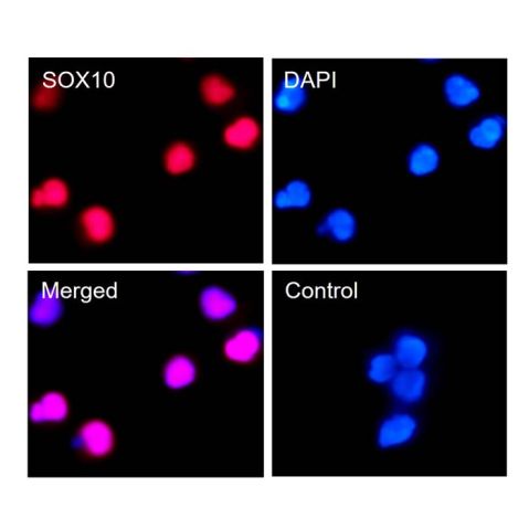 aladdin 阿拉丁 Ab128734 Recombinant SOX10 Antibody Recombinant (RR643); Rabbit anti Human SOX10 Antibody; WB, IHC, Flow, IF/ICC, IP; Unconjugated