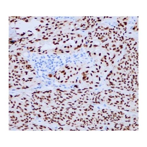 aladdin 阿拉丁 Ab128734 Recombinant SOX10 Antibody Recombinant (RR643); Rabbit anti Human SOX10 Antibody; WB, IHC, Flow, IF/ICC, IP; Unconjugated