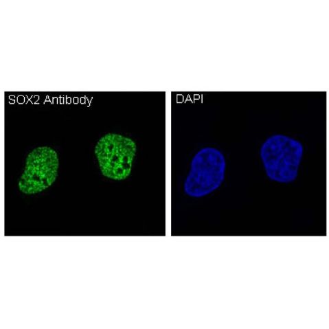 aladdin 阿拉丁 Ab128778 Recombinant SOX2 Antibody Recombinant (R74-1A-2); Rabbit anti Human SOX2 Antibody; WB, IHC, ICC, IF; Unconjugated