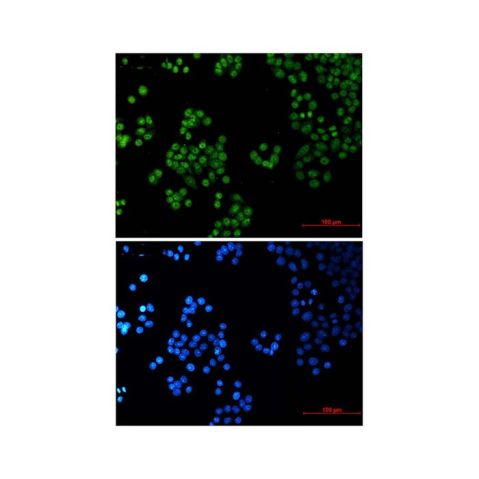 aladdin 阿拉丁 Ab128849 Recombinant SP1 Antibody Recombinant (R01-9G6); Rabbit anti Human SP1 Antibody; WB, IHC, ICC, IF; Unconjugated