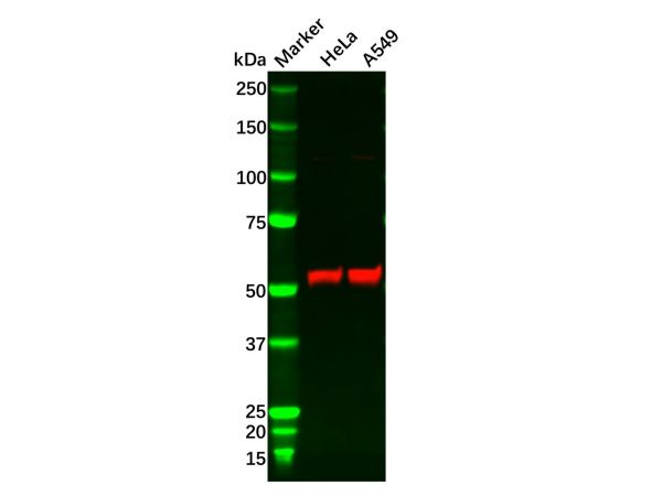 aladdin 阿拉丁 Ab129090 SQSTM1 Mouse mAb mAb (C1); Mouse anti Human SQSTM1 Antibody; WB, IF, ICC; Unconjugated