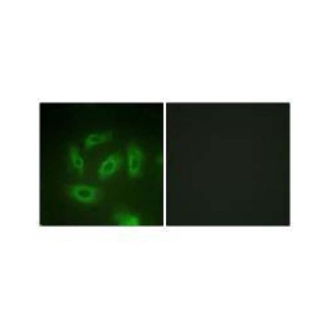 aladdin 阿拉丁 Ab130870 TGF beta Receptor I Antibody pAb; Rabbit anti Human TGF beta Receptor I Antibody; WB, ICC, IF; Unconjugated