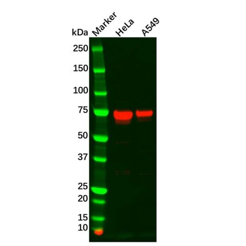 aladdin 阿拉丁 Ab130905 TGFBI Antibody pAb; Rabbit anti Human TGFBI Antibody; WB, IHC; Unconjugated