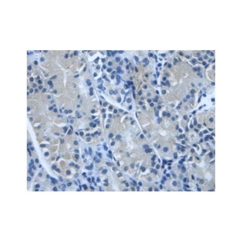 aladdin 阿拉丁 Ab130905 TGFBI Antibody pAb; Rabbit anti Human TGFBI Antibody; WB, IHC; Unconjugated