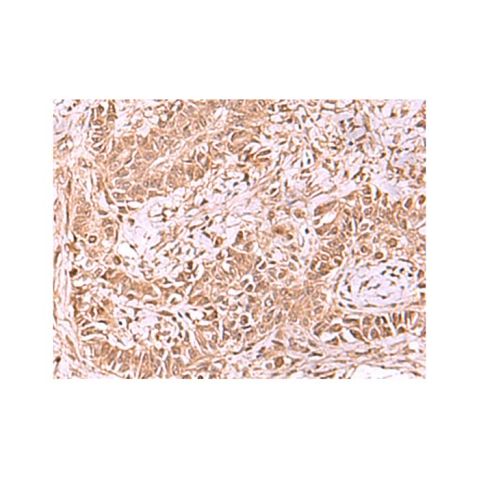 aladdin 阿拉丁 Ab131386 TIP49A Antibody pAb; Rabbit anti Human TIP49A Antibody; WB, IHC; Unconjugated