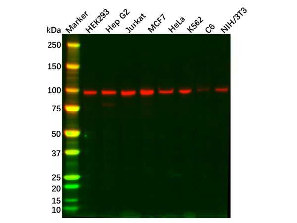 aladdin 阿拉丁 Ab131976 Recombinant Topoisomerase I Antibody Recombinant (R02-2H9); Rabbit anti Human Topoisomerase I Antibody; WB, IHC, ICC, IF; Unconjugated