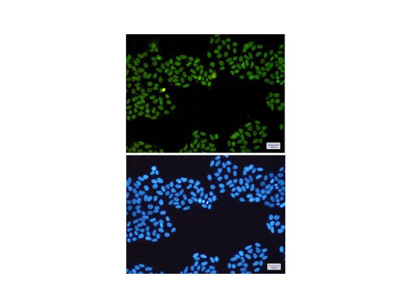 aladdin 阿拉丁 Ab131976 Recombinant Topoisomerase I Antibody Recombinant (R02-2H9); Rabbit anti Human Topoisomerase I Antibody; WB, IHC, ICC, IF; Unconjugated