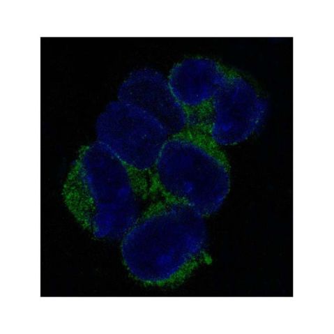 aladdin 阿拉丁 Ab133968 VCAM1 Antibody pAb; Rabbit anti Human VCAM1 Antibody; WB, IHC, ICC, IF; Unconjugated