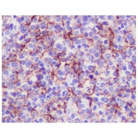 aladdin 阿拉丁 Ab133968 VCAM1 Antibody pAb; Rabbit anti Human VCAM1 Antibody; WB, IHC, ICC, IF; Unconjugated