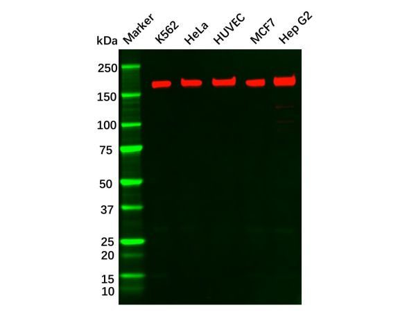 aladdin 阿拉丁 Ab134030 Recombinant VEGF Receptor 1 Antibody Recombinant (R06-1A4); Rabbit anti Human VEGF Receptor 1 Antibody; WB, IHC; Unconjugated