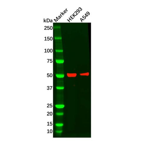 aladdin 阿拉丁 Ab134682 Recombinant Wilms Tumor Protein Antibody Recombinant (R05-2C6); Rabbit anti Human Wilms Tumor Protein Antibody; WB, IHC; Unconjugated