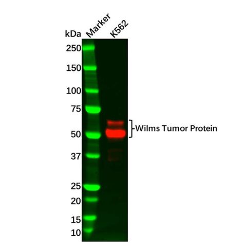 aladdin 阿拉丁 Ab134682 Recombinant Wilms Tumor Protein Antibody Recombinant (R05-2C6); Rabbit anti Human Wilms Tumor Protein Antibody; WB, IHC; Unconjugated