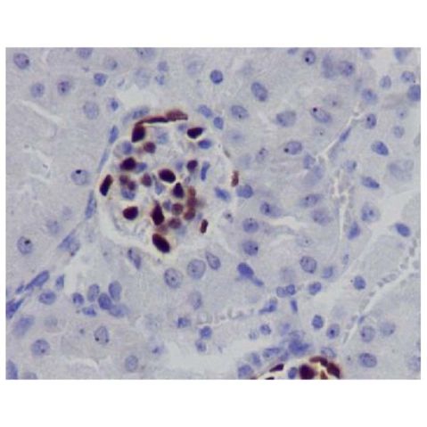 aladdin 阿拉丁 Ab134682 Recombinant Wilms Tumor Protein Antibody Recombinant (R05-2C6); Rabbit anti Human Wilms Tumor Protein Antibody; WB, IHC; Unconjugated