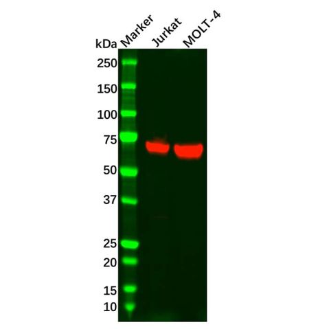aladdin 阿拉丁 Ab135101 Recombinant ZAP70 Antibody Recombinant (R01-6H7); Rabbit anti Human ZAP70 Antibody; WB; Unconjugated
