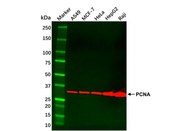 aladdin 阿拉丁 cl155896 Hep G2 Whole Cell Lysate 200μg, Mycoplasma free