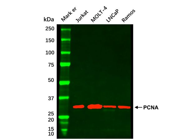 aladdin 阿拉丁 cl155905 MOLT-4 Whole Cell Lysate 200μg, Mycoplasma free