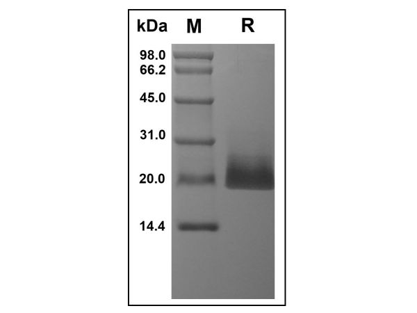 aladdin 阿拉丁 rp142386 Recombinant Human 4-1BB Ligand Protein Animal Free, >95%(SDS-PAGE, HPLC), Active, E.coli, No tag, 71-254 aa