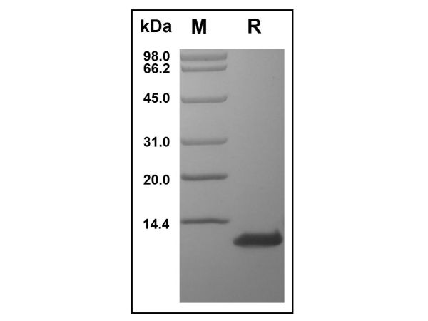 aladdin 阿拉丁 rp143723 Recombinant Human CCL1 Protein Animal Free, >97%(SDS-PAGE and HPLC), Active, E.coli, No tag, 23-96 aa