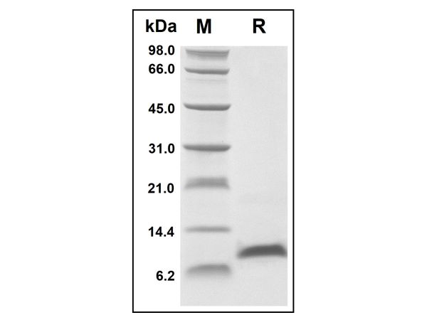 aladdin 阿拉丁 rp143727 Recombinant Human CCL14 Protein Animal Free, >96%(SDS-PAGE and HPLC), Active, E.coli, No tag, 22-93 aa