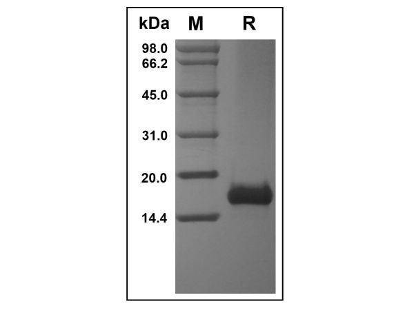 aladdin 阿拉丁 rp143734 Recombinant Human CCL21 Protein Animal Free, >97%(SDS-PAGE and HPLC), Active, E.coli, No tag,  24-134 aa