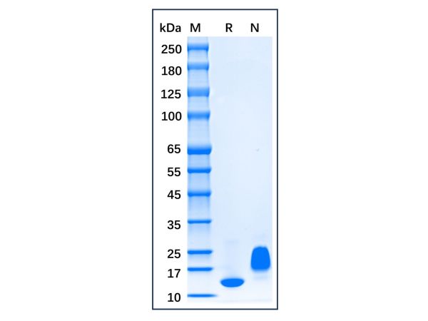 aladdin 阿拉丁 rp143745 Recombinant Human CCL28 Protein  Animal Free, >96% (SDS-PAGE, HPLC), Active, E.coli, No tag, 20-127 aa