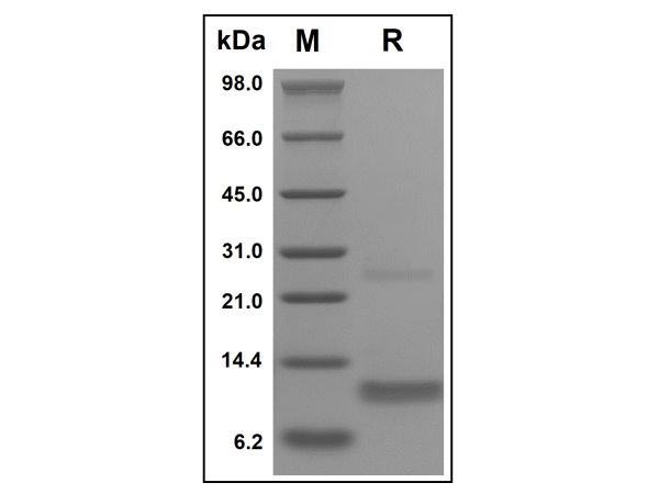 aladdin 阿拉丁 rp143746 Recombinant Human CCL4/MIP-1 beta Protein Animal Free, >96%(SDS-PAGE, HPLC), Active, E.coli, No tag, 24-92 aa