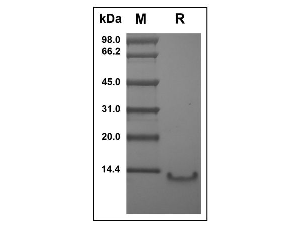 aladdin 阿拉丁 rp143752 Recombinant Human CCL4L1 Protein Animal Free, >97%(SDS-PAGE, HPLC), Active, E.coli, No tag, 24-92 aa