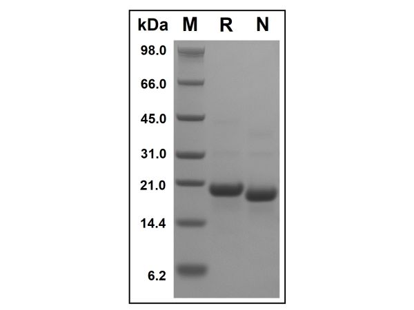 aladdin 阿拉丁 rp143894 Recombinant Human CD23 Protein Animal Free, >95%(SDS-PAGE, HPLC), Active, E.coli, No tag, 150-321 aa