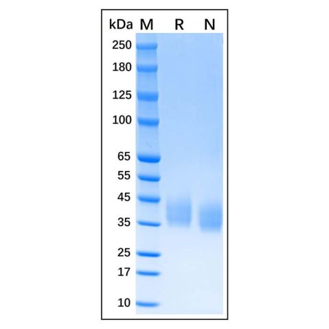 aladdin 阿拉丁 rp143912 Recombinant Human CD276 Protein Animal Free, >95% (SDS-PAGE), Active, 293F, His tag, 29-246 aa
