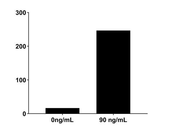 aladdin 阿拉丁 rp144864 Recombinant Human CXCL5 Protein Animal Free, >97% (SDS-PAGE, HPLC), Active, E. coli, No tag, 41-114 aa