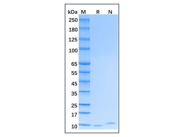 aladdin 阿拉丁 rp144864 Recombinant Human CXCL5 Protein Animal Free, >97% (SDS-PAGE, HPLC), Active, E. coli, No tag, 41-114 aa