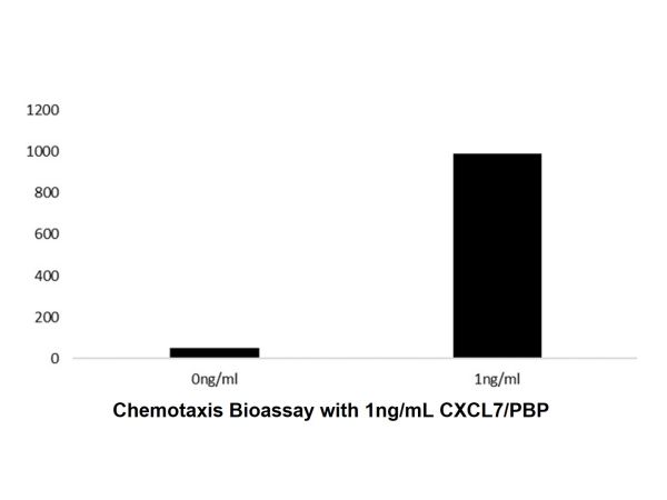 aladdin 阿拉丁 rp144868 Recombinant Human CXCL7/PBP Protein Animal Free, >97%( SDS-PAGE and HPLC), Active, E.coli, No tag, 59-128 aa