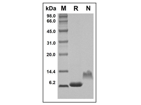 aladdin 阿拉丁 rp144868 Recombinant Human CXCL7/PBP Protein Animal Free, >97%( SDS-PAGE and HPLC), Active, E.coli, No tag, 59-128 aa