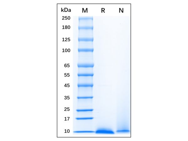 aladdin 阿拉丁 rp147252 Recombinant Human IGF-1 Protein Animal Free, >95% SDS-PAGE, Active, E.coli, No tag, 49-188aa