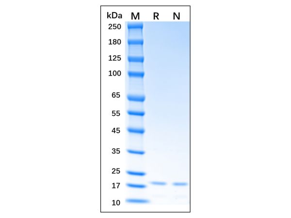 aladdin 阿拉丁 rp147371 Recombinant Human IL-11 Protein Animal Free, >96% (SDS-PAGE,HPLC), Active, E. coli, No tag, 22-199 aa