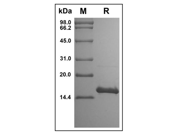 aladdin 阿拉丁 rp147435 Recombinant Human IL-17F Protein Animal Free, >95%(SDS-PAGE, HPLC), Active, E.coli, No tag, 31-163 aa