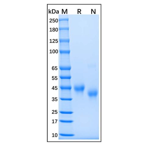 aladdin 阿拉丁 rp147480 Recombinant Human IL-2 Receptor Alpha Protein Animal Free, >97%(SDS-PAGE), Active, HEK293, C-His tag, 22-213 aa