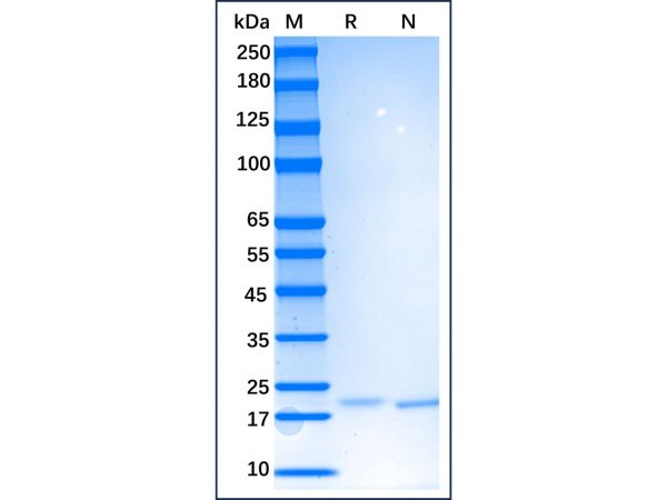 aladdin 阿拉丁 rp147615 Recombinant Human IL-6 Protein Animal Free, >95% SDS-PAGE, Active, E.coli, No tag, Pro29-Met212