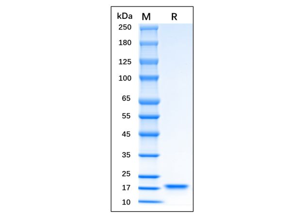 aladdin 阿拉丁 rp148028 Recombinant Human KGF/FGF-7 Protein Animal Free, >95% SDS-PAGE, Active, E.coli, No tag, 32-194aa