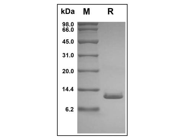 aladdin 阿拉丁 rp148449 Recombinant Human XCL1 Protein Animal Free, >98%( SDS-PAGE and HPLC), Active, E.coli, No tag,  23-114 aa