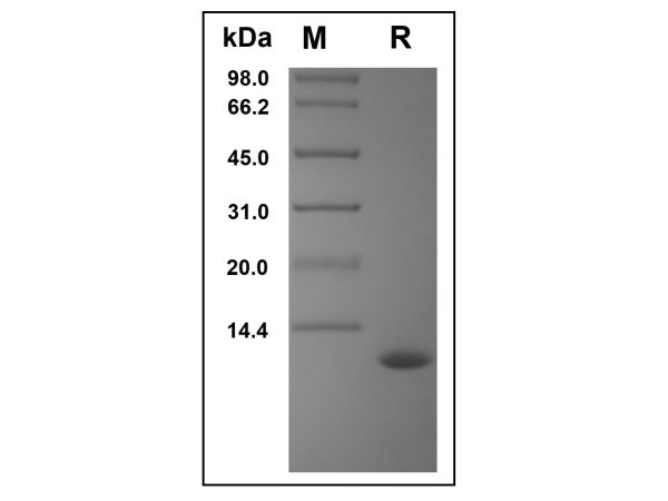 aladdin 阿拉丁 rp148478 Recombinant Human CCL15 Protein Animal Free, >97%(SDS-PAGE, HPLC), Active, E.coli, No tag, 22-113aa