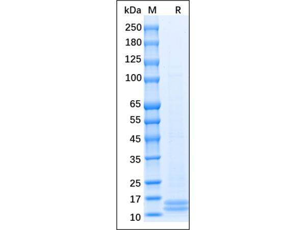 aladdin 阿拉丁 rp148600 Recombinant Human MCP1 Protein Animal Free, >92% (SDS-PAGE), Active, E. coli, His tag, 24-99 aa