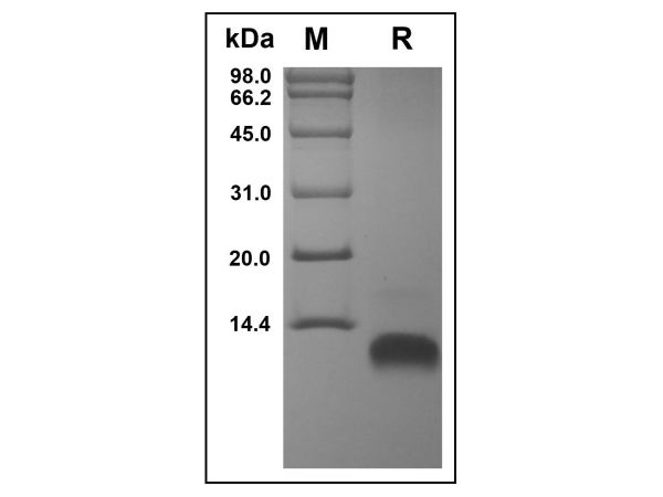 aladdin 阿拉丁 rp148631 Recombinant Human MDC Protein Animal Free, >97%(SDS-PAGE, HPLC), Active, E.coli, No tag, 25-93aa