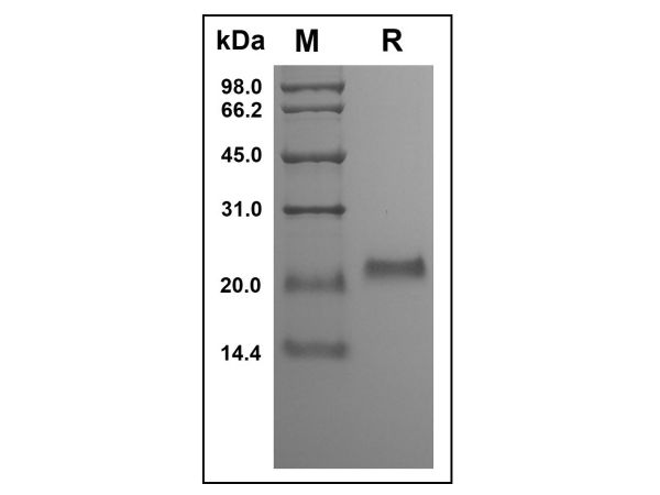 aladdin 阿拉丁 rp149600 Recombinant Human Osteoprotegerin Protein Animal Free, >95%(SDS-PAGE, HPLC), Active, E.coli, No tag, 22-194 aa